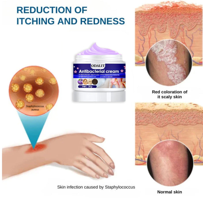 ODALIT™ Herbal Antibacterial cream
