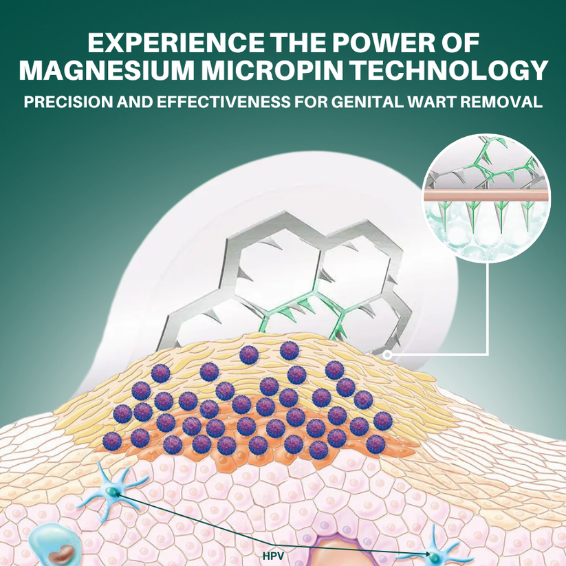 ODALIT™ Genital Wart Removal Patch – Now 40% OFF | Pain-Free, Clinically Proven Solution