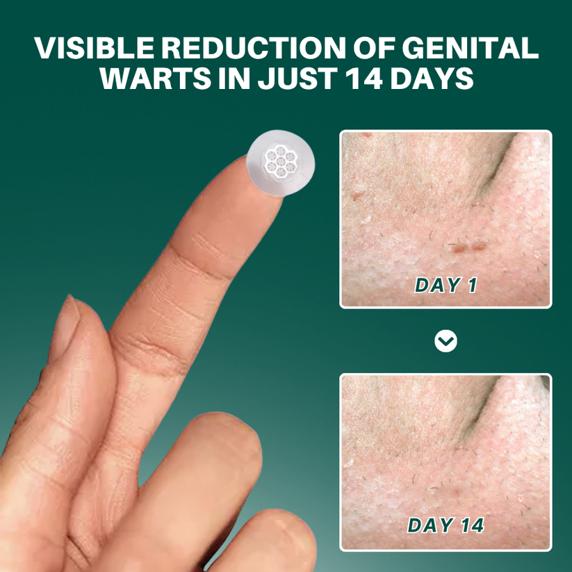 ODALIT™ Genital Wart Removal Patch – Now 40% OFF | Pain-Free, Clinically Proven Solution