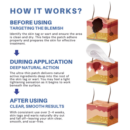 🔥ODALIT™ Natural Skin Tag and Wart Removal Patches