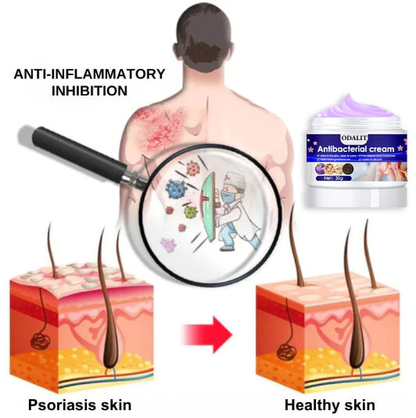 ODALIT™ Herbal Antibacterial cream
