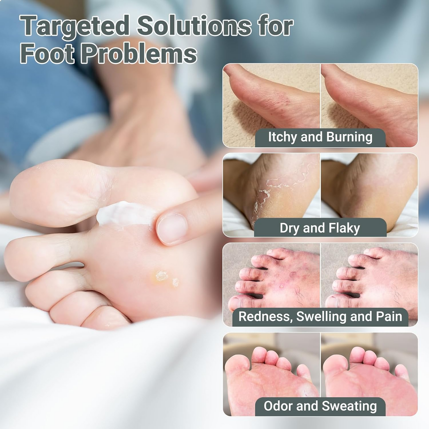 ODALIT™ Tea Tree Oil Antifungal Foot Cream