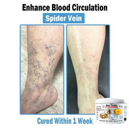 ODALIT™✨ Bee Toxin Multi-Symptom Skin Treatment Cream (👨‍⚕NPF RECOMMENDS)