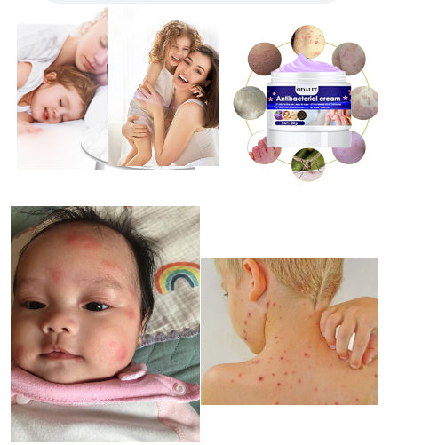 ODALIT™ Herbal Antibacterial cream