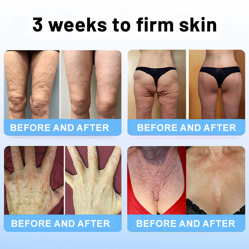 💎ODALIT™ Botox Bee Venom Firming Serum Stick(🔥LAST DAY 70% OFF)🧡