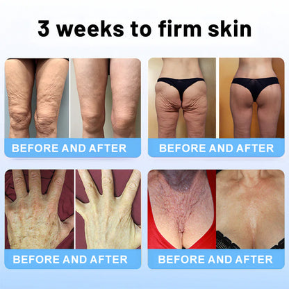 💎ODALIT™ Botox Bee Venom Firming Serum Stick(🔥LAST DAY 70% OFF)🧡