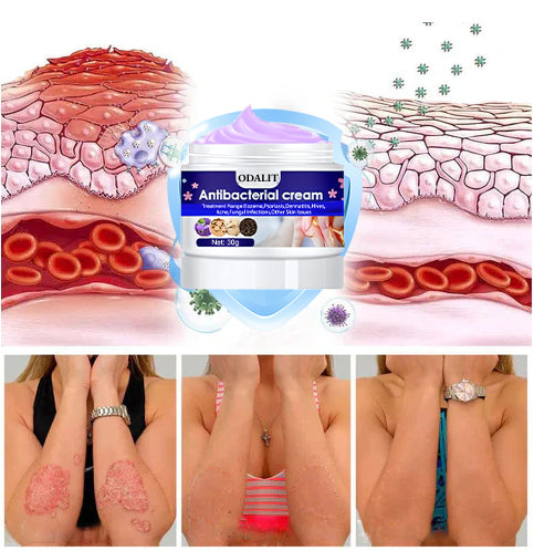 ODALIT™ Herbal Antibacterial cream