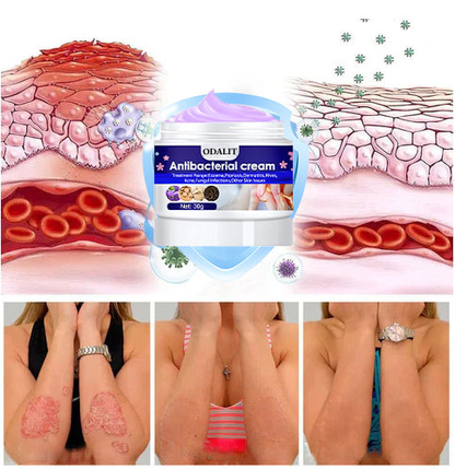 ODALIT™ Herbal Antibacterial cream